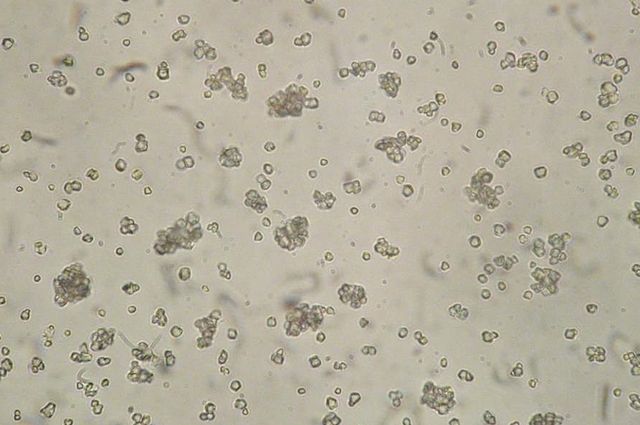Stärkekörner unter dem Mikroskop - By MKD - Own work, CC BY-SA 3.0, https://commons.wikimedia.org/w/index.php?curid=30608450